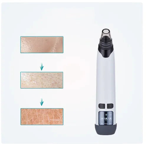 ClearPore™ Vakuum Pro